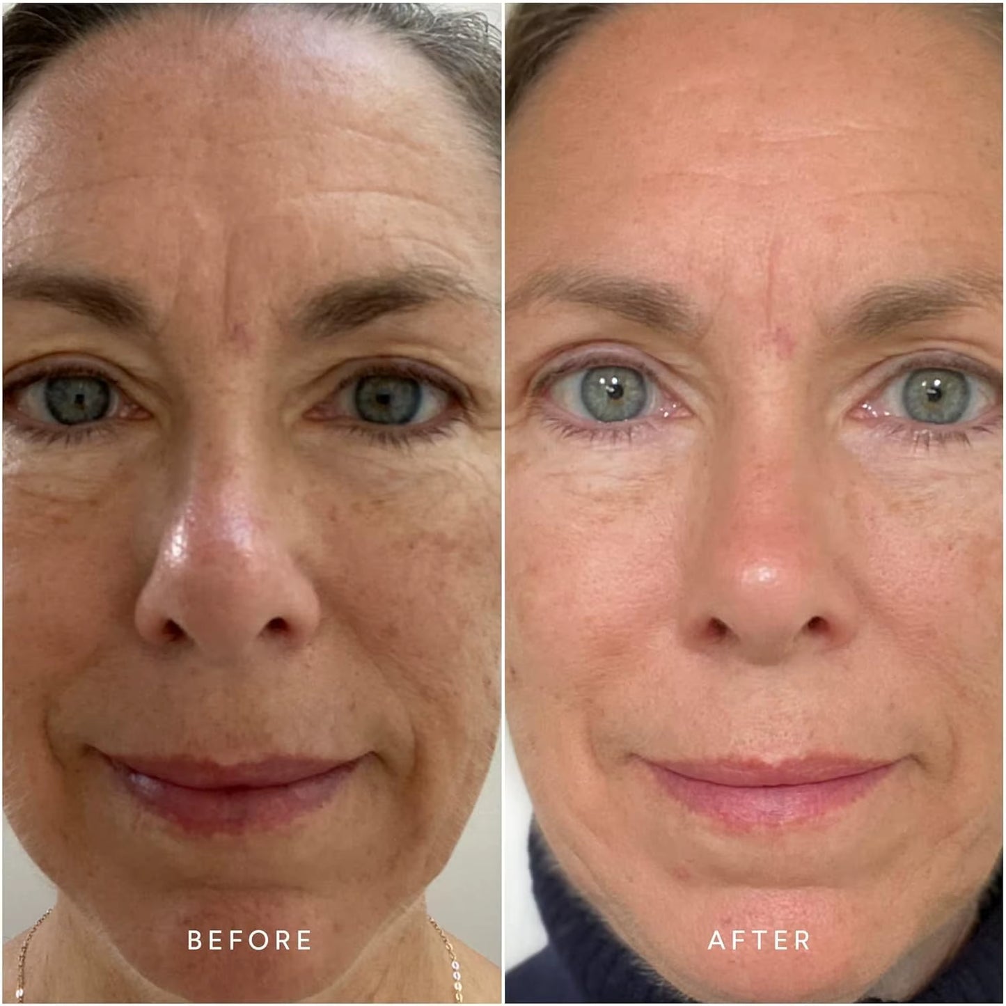 Copper Peptide Anti-Aging Facial Essence